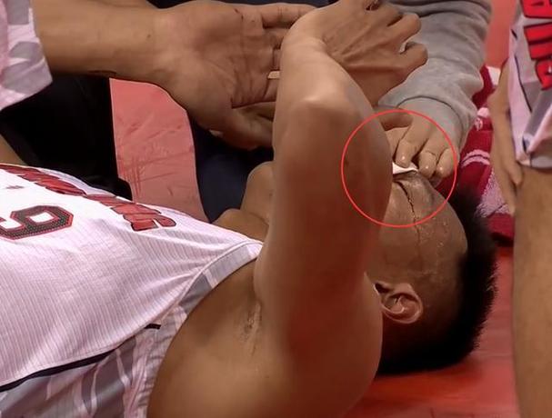 易建联什么时候受伤